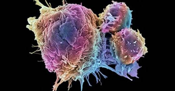 La quimioterapia puede extender el cáncer y desencadenar tumores más agresivos, dice nueva investigación