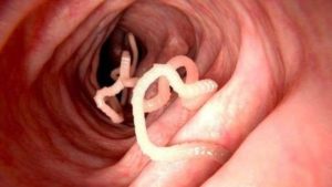 Las tenias y lombrices pueden llegar al intestino al ingerir alimentos contaminados mal cocidos fertilizados con heces no tratadas. 